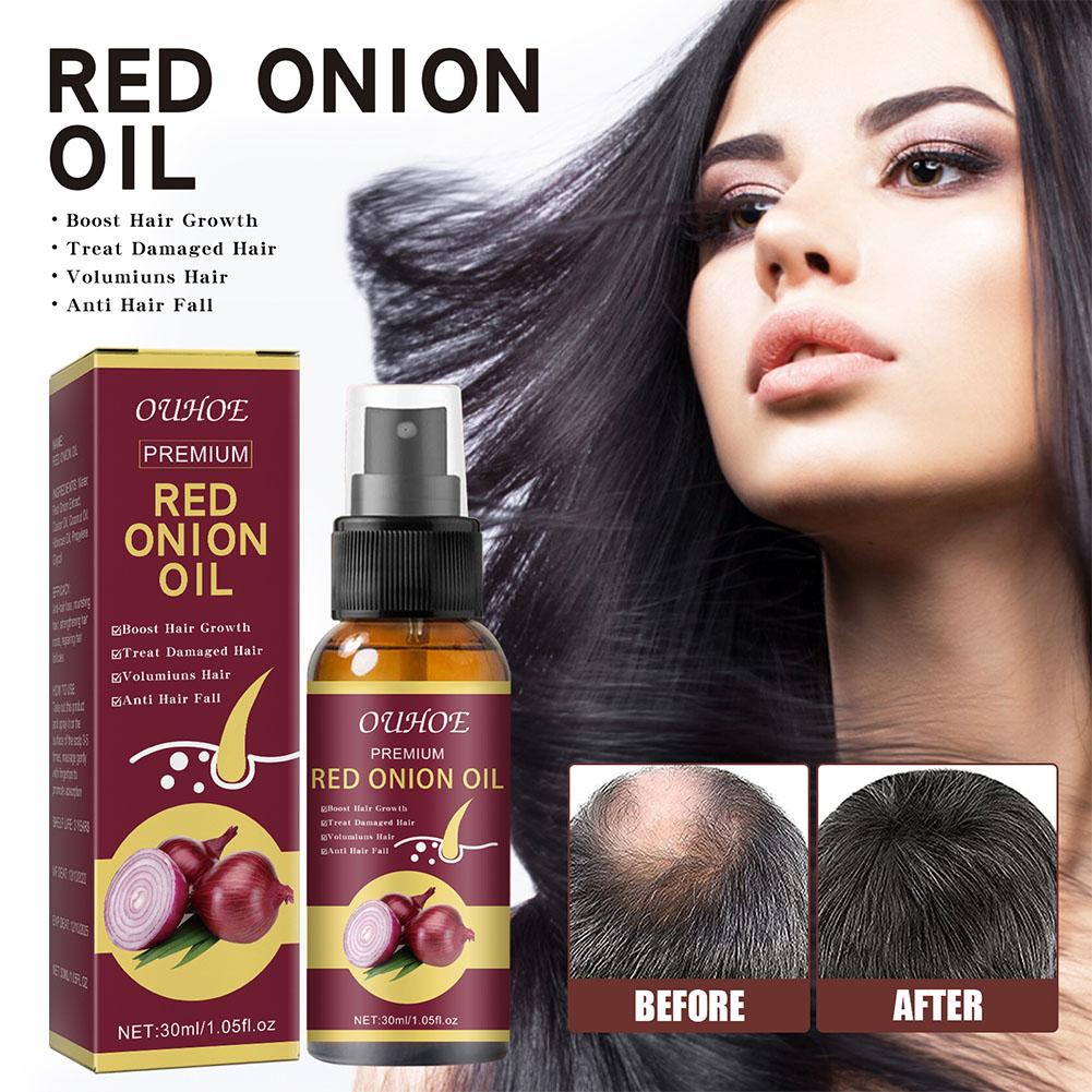 Hair Care Ouai - OUHOE สเปรย์น้ำมันหอมระเหยหัวหอมแดงสกัดผมแข็งแรงและชุ่มชื้นสำหรับการดูแลเส้นผมและการเจริญเติบโตป้องกันผมร่วง H5M8