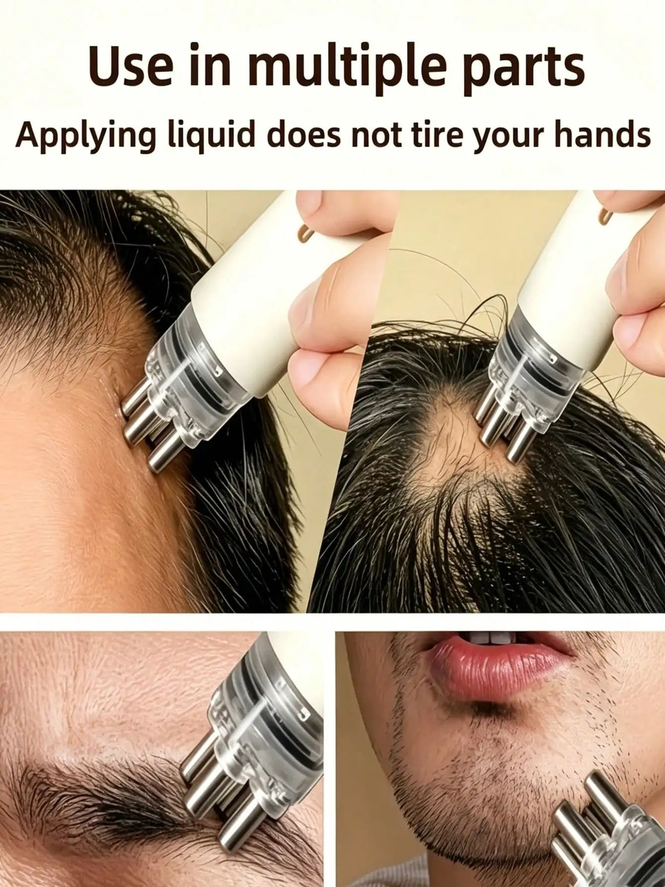 Hair Care Serum - อุปกรณ์ทาเซรั่มบำรุงหนังศีรษะแบบพกพา หวีลูกกลิ้งสำหรับทาเซรั่มเร่งผมยาว, หวีทาเซรั่มบำรุงหนังศีรษะแบบพกพา, หวีนวดดูแลเส้นผมปรับความเร็วได้, อุปกรณ์นวดหนังศีรษะ, ช่วยให้หนังศีรษะเรียบเนียน,