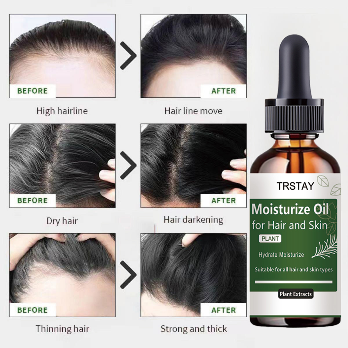 TRSTAY น้ํามันหอมระเหยโรสแมรี่ - Rosemary Hair Oil บทวิจารณ์และราคา
