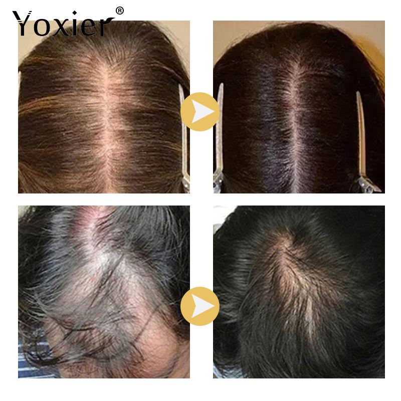 Intensive Growth Serum ป้องกัน - Hair Care Serum บทวิจารณ์และราคา